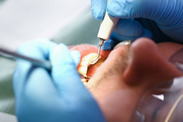 Best Weekend Emergency Dentist in Fairplains, NC