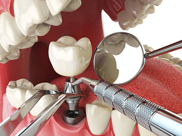 Best Mobile Emergency Dentist in Fairplains, NC